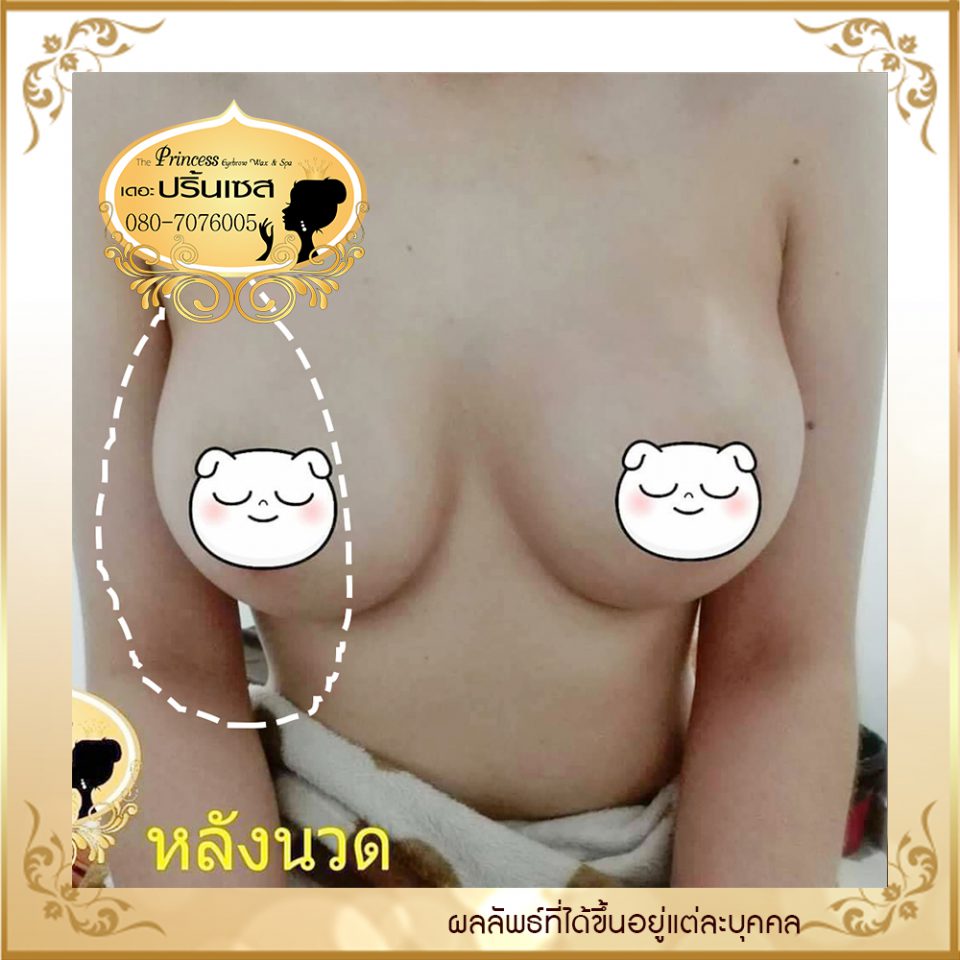 นวดนม นวดหน้าอกหลังศัลยกรรม นวดนมซิลิโคน นวดนมพังผืด