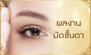 มัดชั้นหนังตา