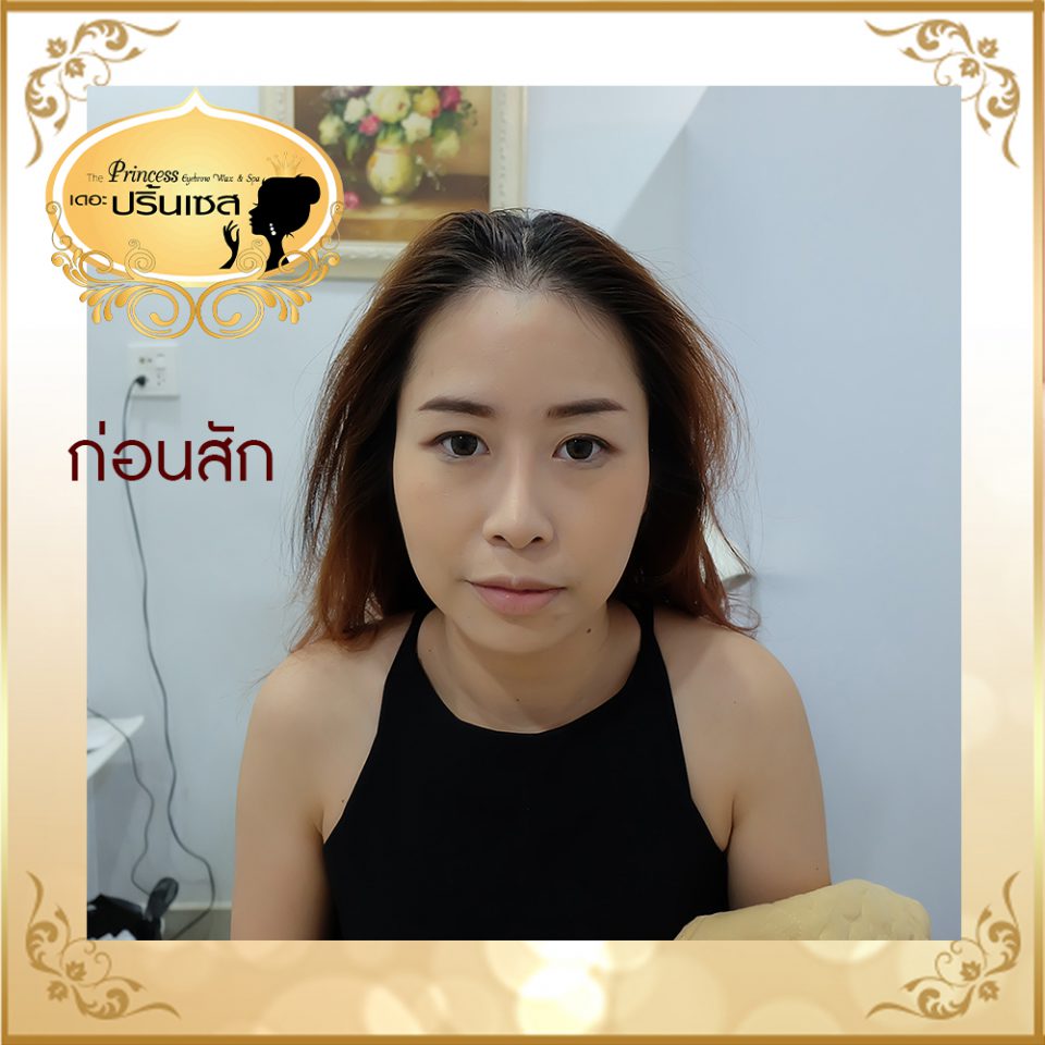 สอนสักไรผม แก้หัวล้าน หาดใหญ่ กรุงเทพ
