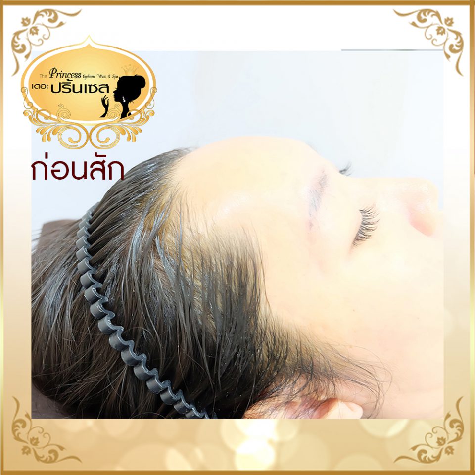สอนสักไรผม แก้หัวล้าน หาดใหญ่ กรุงเทพ